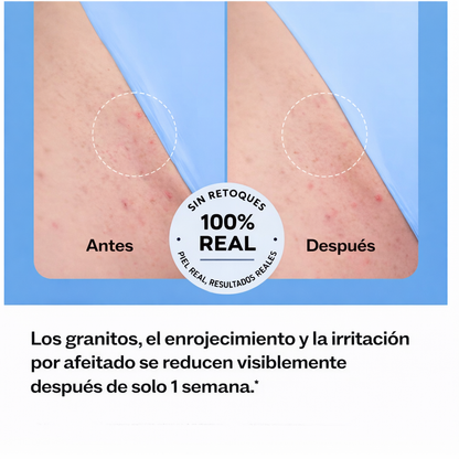 Roll-On Anti Pelos Encarnados – Elimina Irritación y Manchas